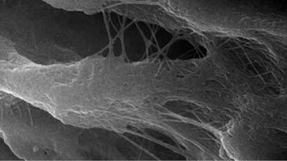 Od každodenní stomatologie k pokročilým fotoakustickým endodontickým prostředkům (PIPS): laser s dvojí vlnovou délkou Er:YAG & Nd:YAG