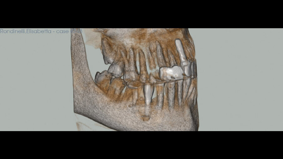 Fig. 19