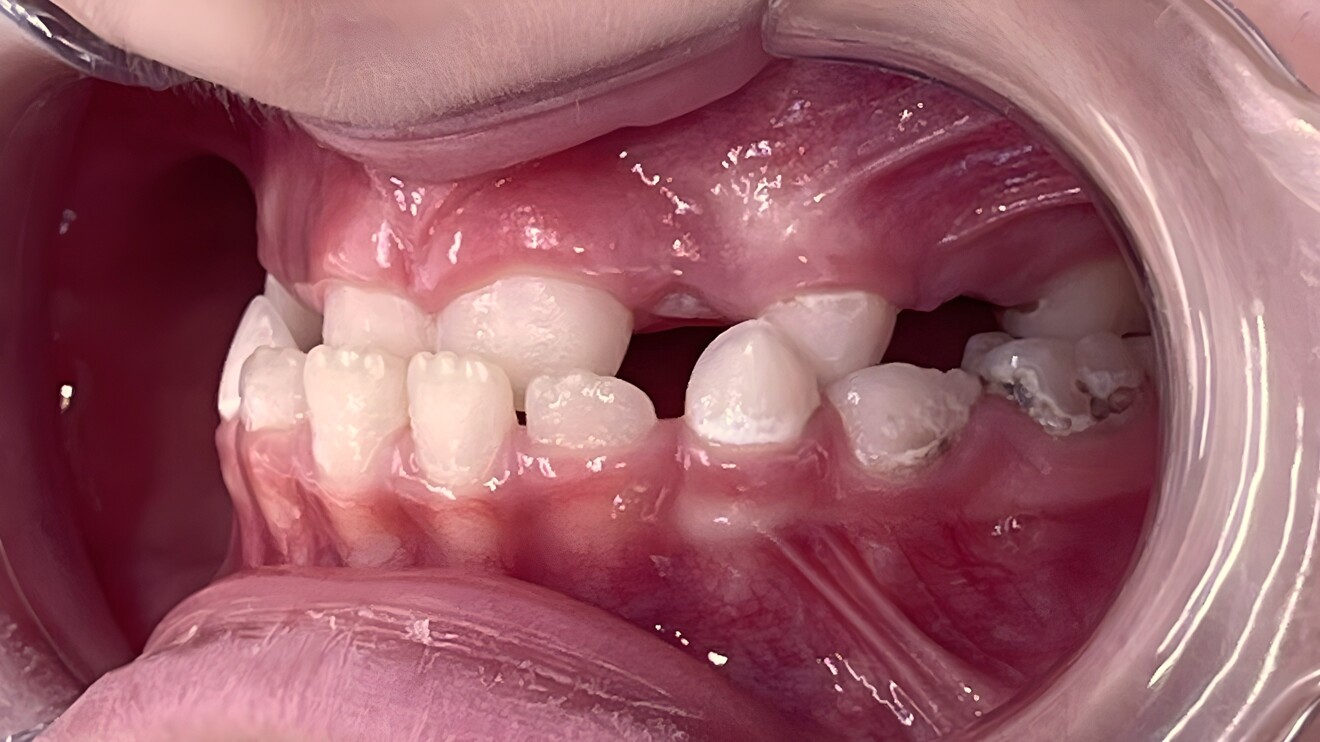 Fig. 1f