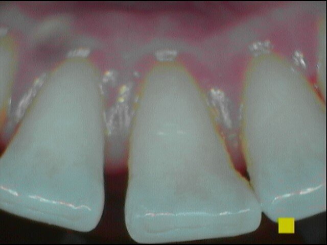 Fig. 4b