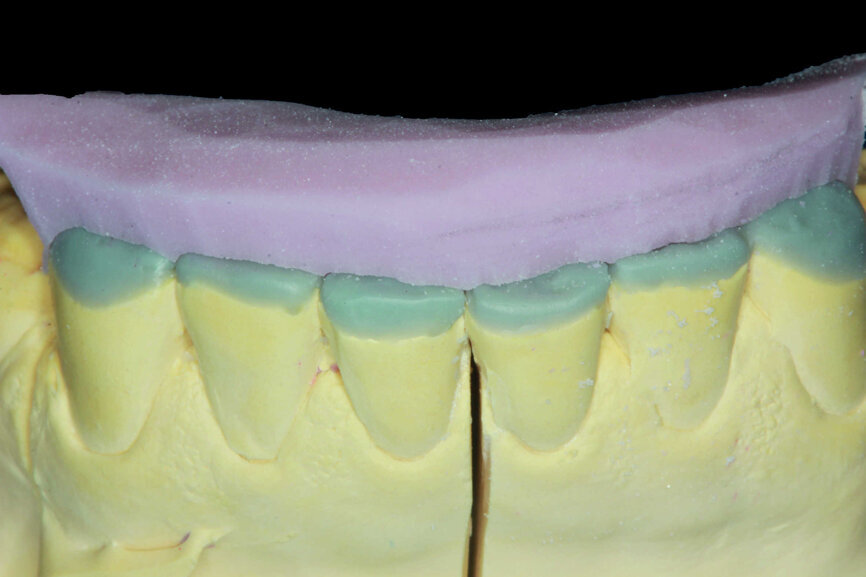 Fig.24
