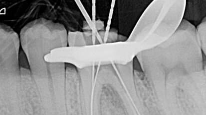 Un nuovo livello di flessibilità: F6 SkyTaper