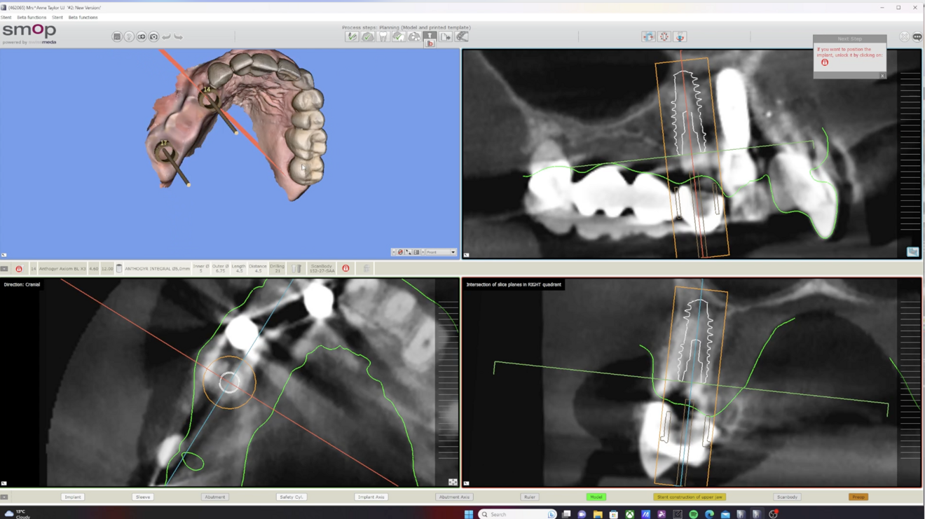 Fig. 6