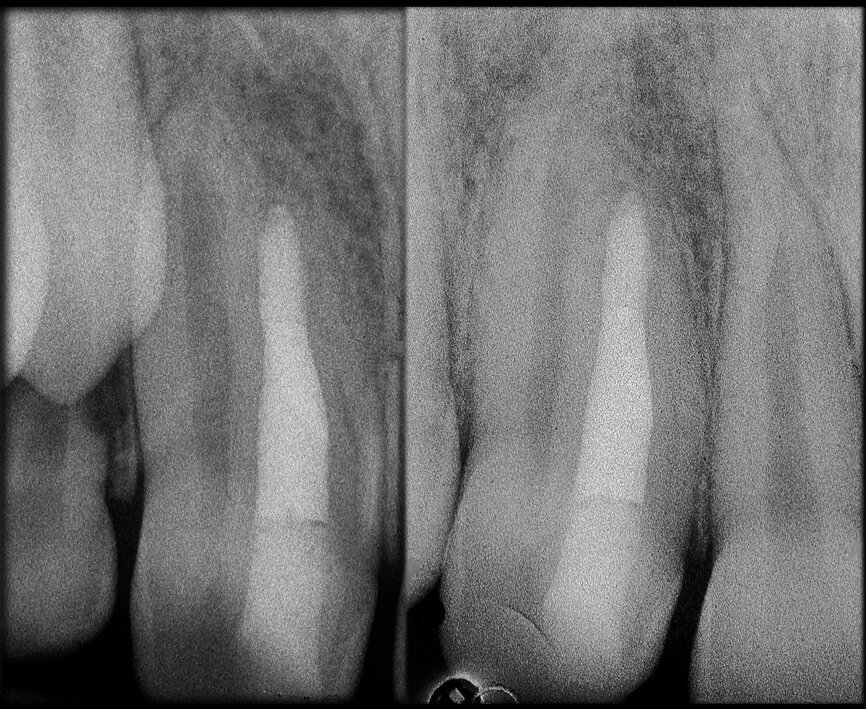 Fig. 37