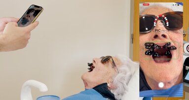 PIC dental: 15 años impulsando la fotogrametría en implantología
