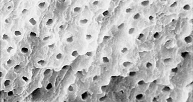 Il punto sull’irrigazione in endodonzia (seconda parte)