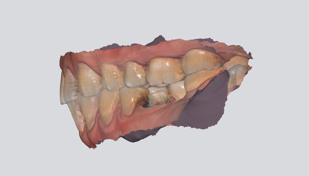 Fig. 18
