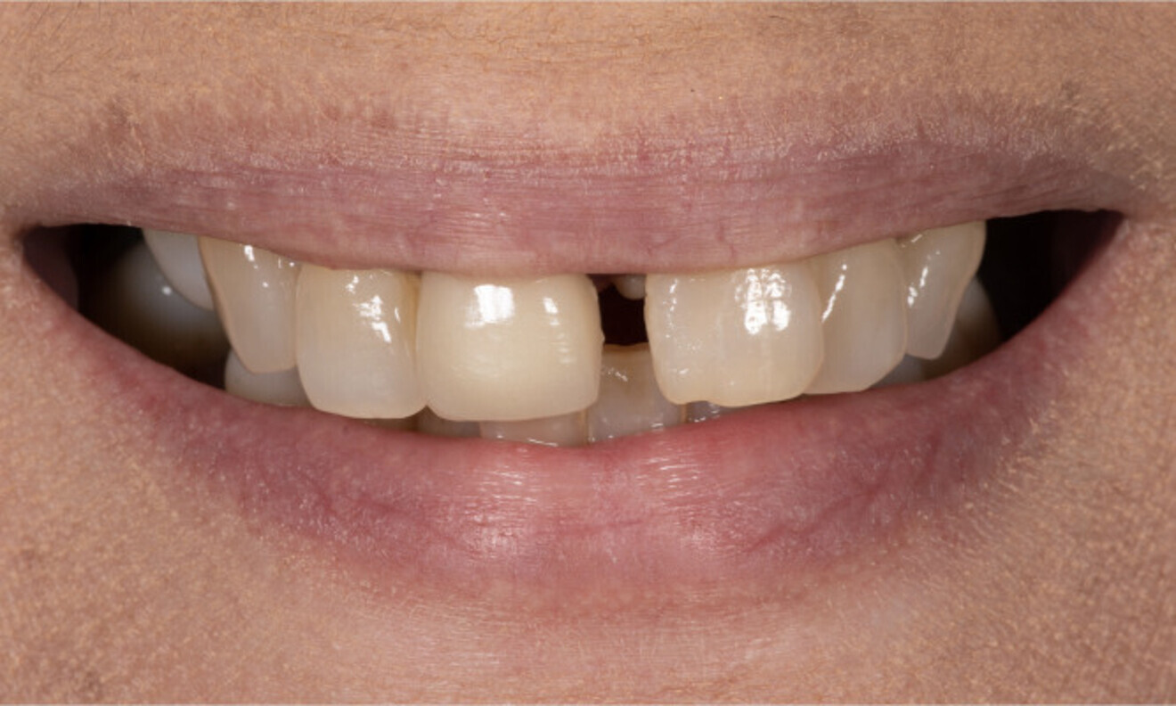 Fig. 16