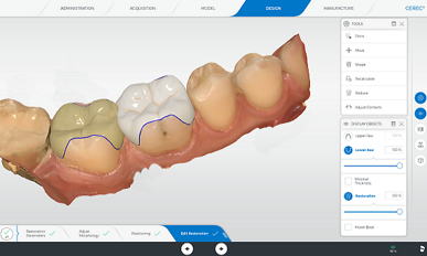 CEREC Software