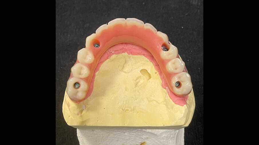 Fig. 13