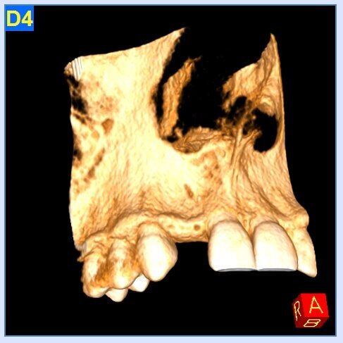 Fig.:1a