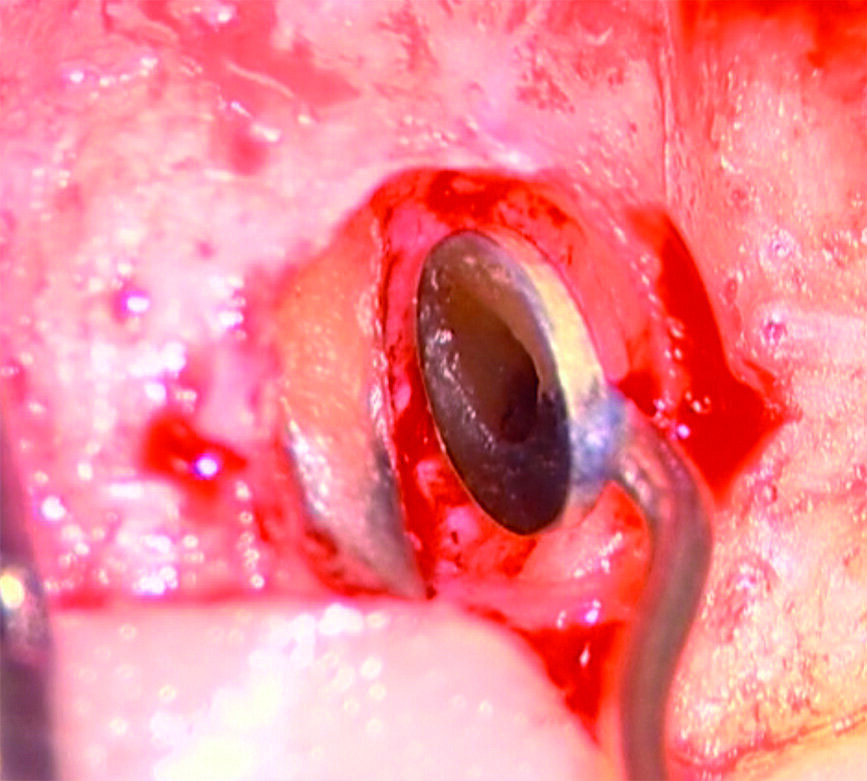 Fig. 2b