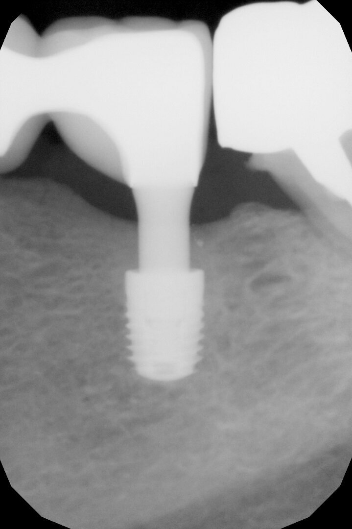 Fig. 6b