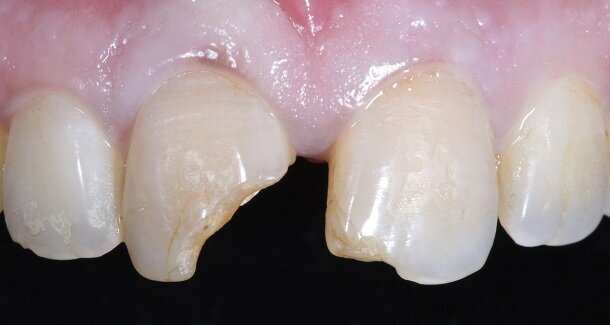 FIG02