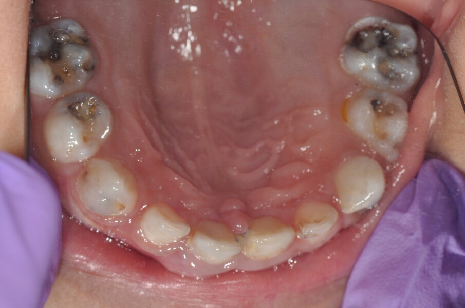 Fig. 11: Preoperative situation.