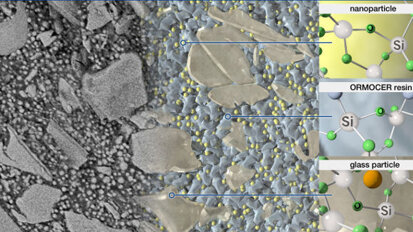 Webinar: Expert presents first purely ceramic-based restorative material