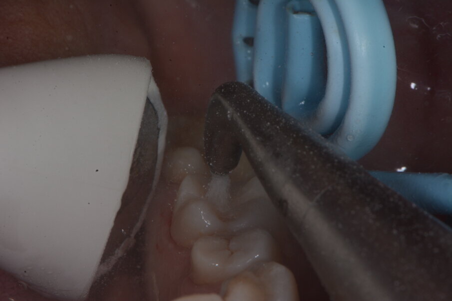 Fig. 7b