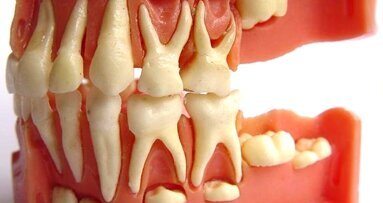 Odonto Ideias Nº 12: Banco de Dentes Humanos