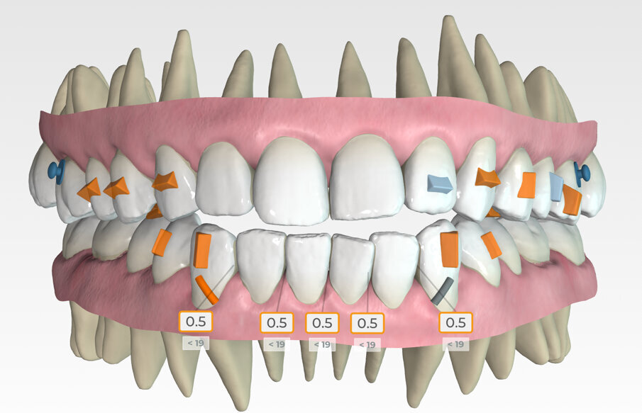 Fig. 13