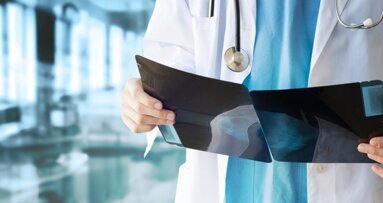 A doença periodontal aumenta o risco de câncer de mama em mulheres na pós-menopausa