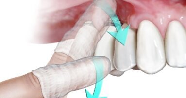 Un protocollo semplice ed efficace con l’obiettivo di prevenire il contagio da Coronavirus