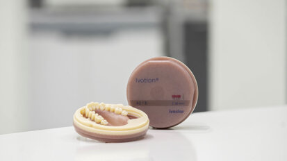 Ivoclar introduces new gingiva and tooth shades to meet rising demand for personalised prostheses