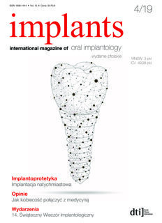 implants Poland No. 4, 2019