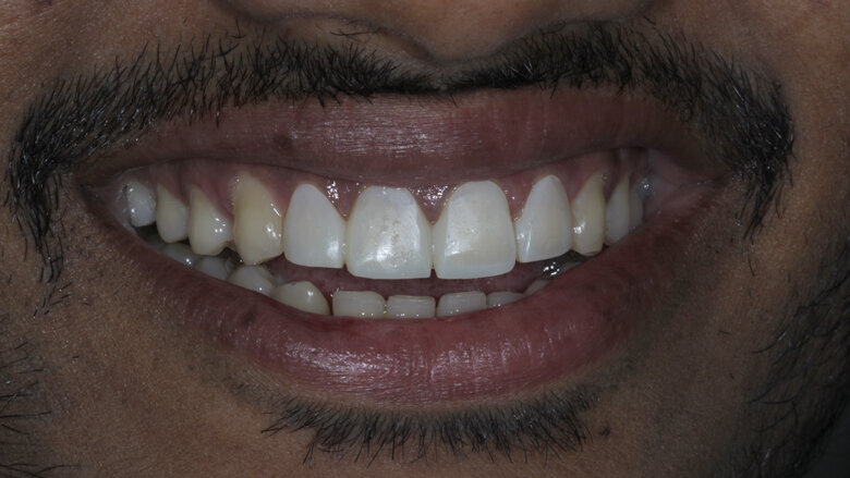 Pic 5