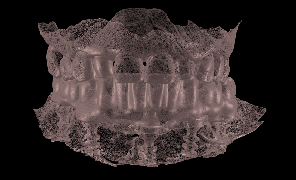 Fig. 13b