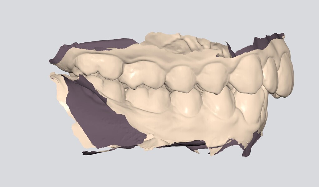 Fig 10. 