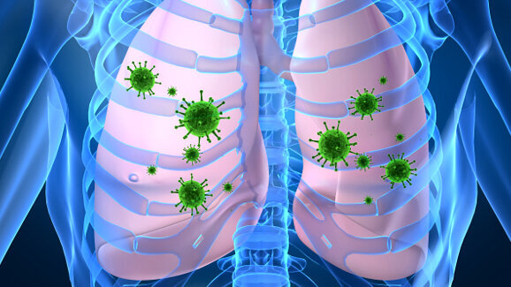 Irish dentists warn of potential dangers of dental infection
