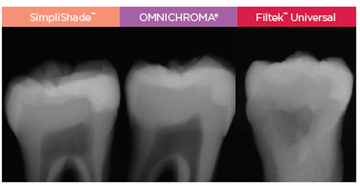radiography