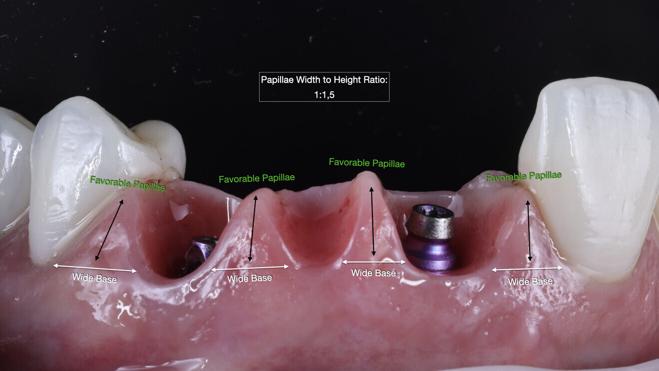 Fig. 34