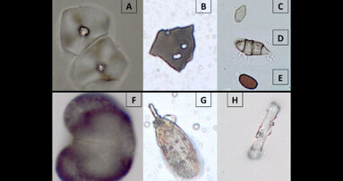 Ancient dental plaque reveals living conditions and diet of early hominins