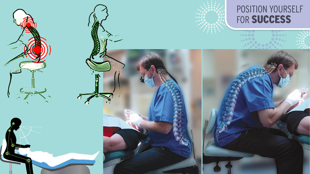 How to avoid strain, musculoskeletal issues in dental practice