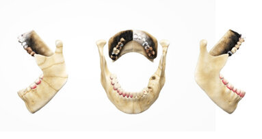 Forensic odontology education: The interactive capability of 3D models facilitates deeper comprehension