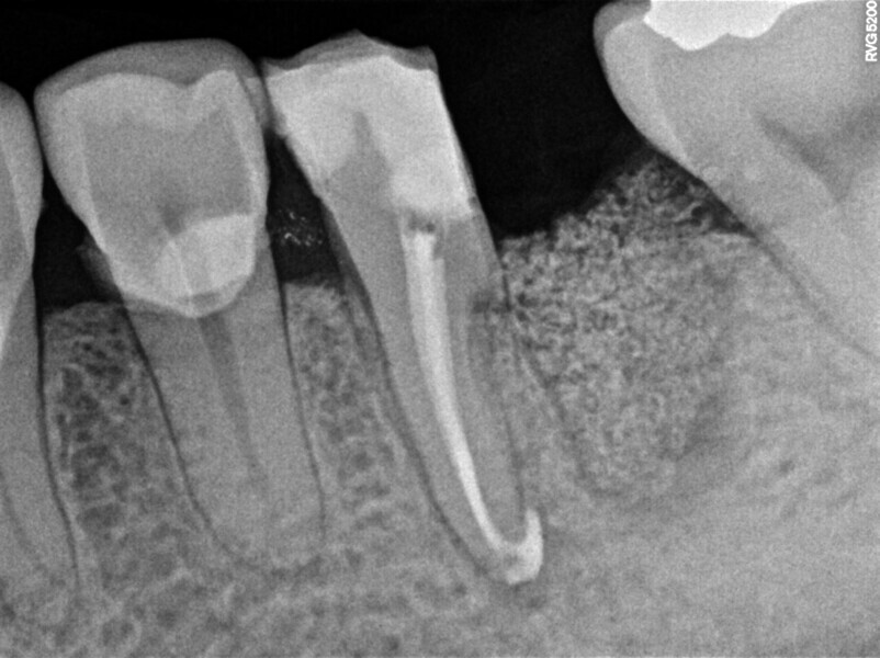 Fig. 10