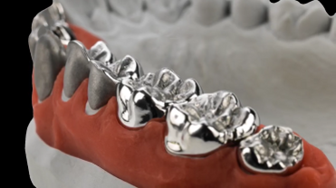 Ceramill Sintron