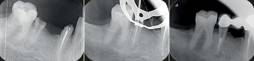 Fig. 10 : Cas clinique Dr Camille Bertrand.