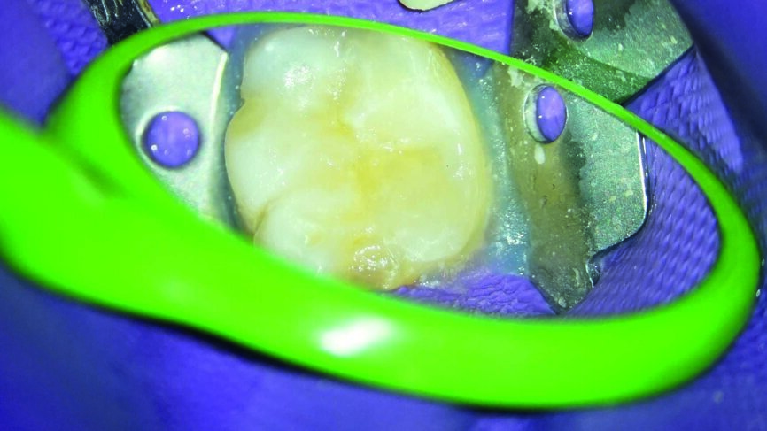 Fig. 8