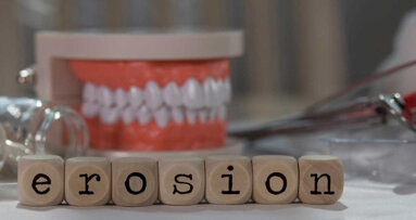Estudo examina conhecimento sobre desgaste dentário erosivo entre dentistas dinamarqueses
