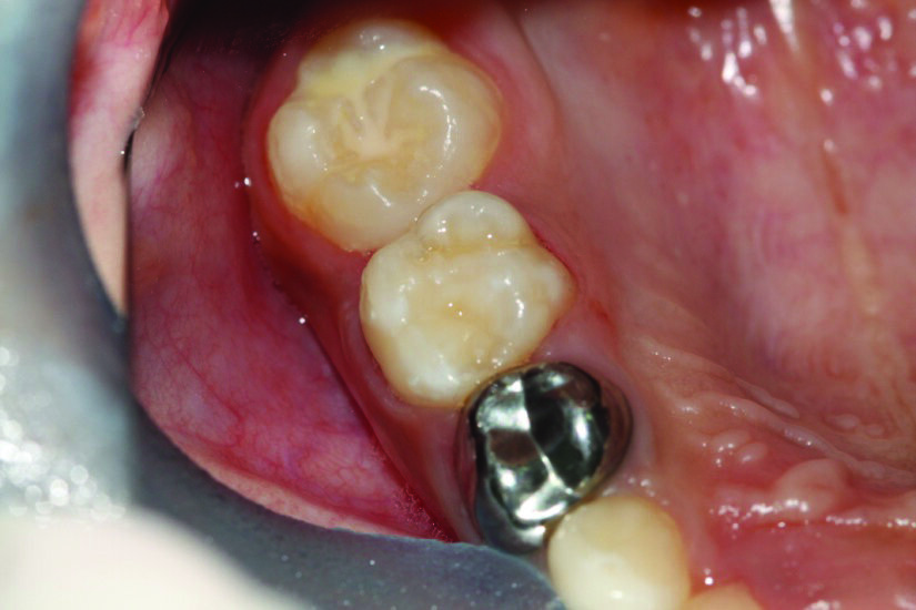 Figure 6c