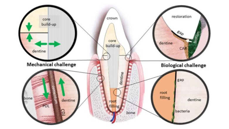 Grundlage für robustere dentale Biomaterialien