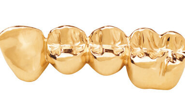 Aurident’s GH gold casting alloy lowers costs