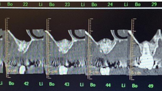 Fig. 21