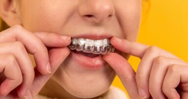 El blanqueamiento dental en niños y adolescentes
