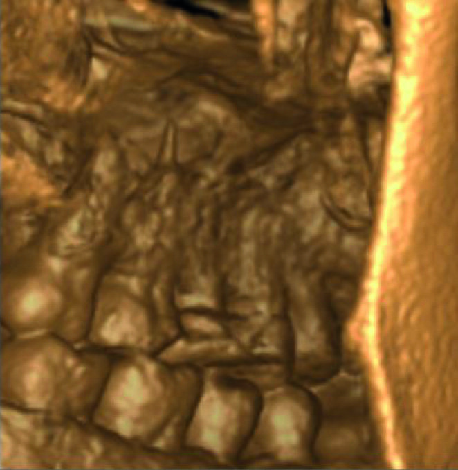 Fig. 9
