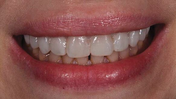 Let patients test-drive their new smiles