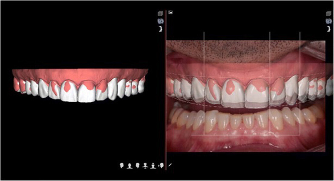Fig. 11. Planificación del Diseño Digital de Sonrisa.