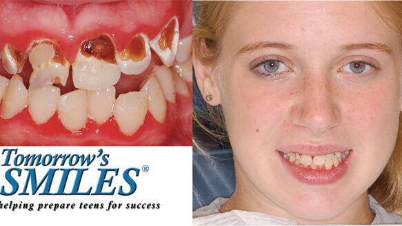 A smile makes a difference for a teen in need